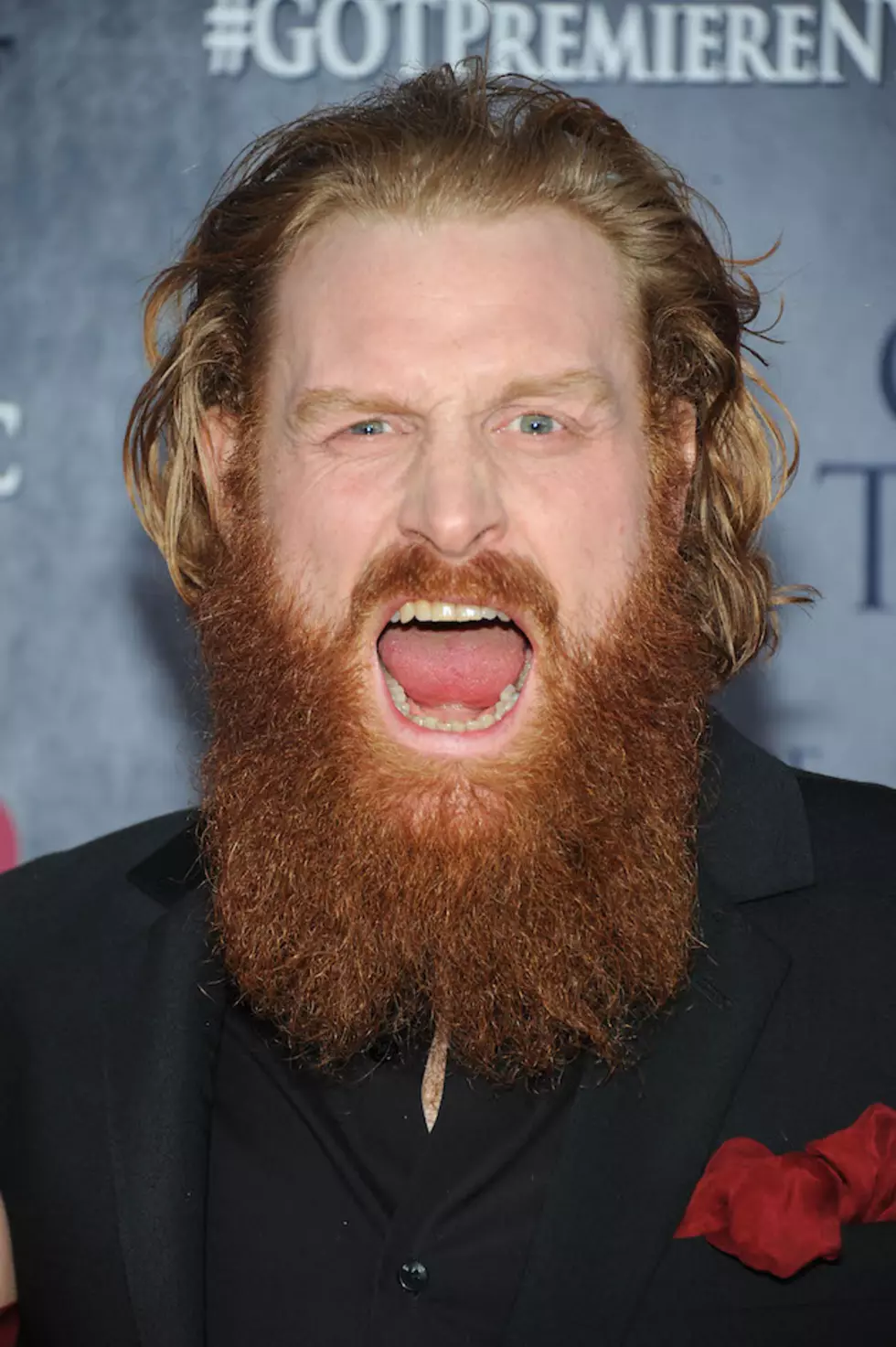 Kristofer Hivju of &#8216;Game of Thrones&#8217; Shaves His Beard! &#8211; [VIDEO]