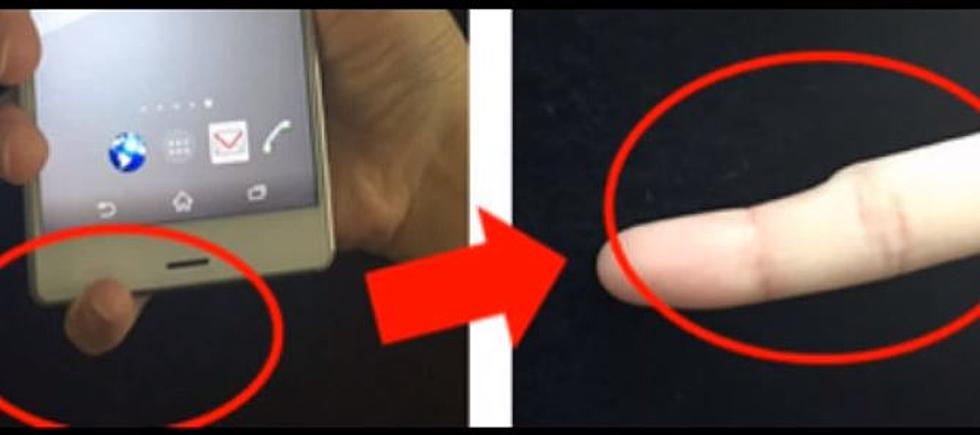 Do You Have Smartphone Pinky? Smartphones Causing Deformed Pinkies – Leo and Rebecca (Audio)