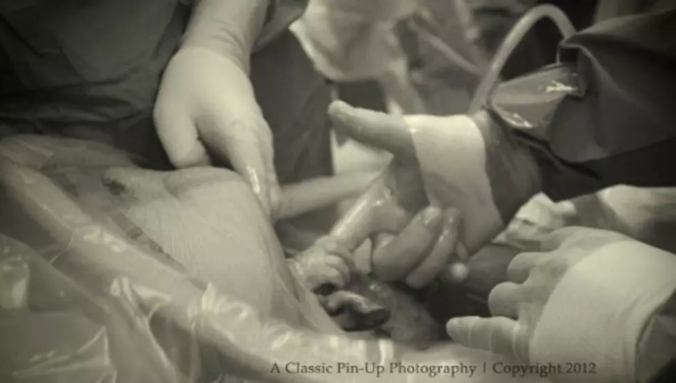 Unborn Baby Holding a Doctor’s Hand Captured on Photo