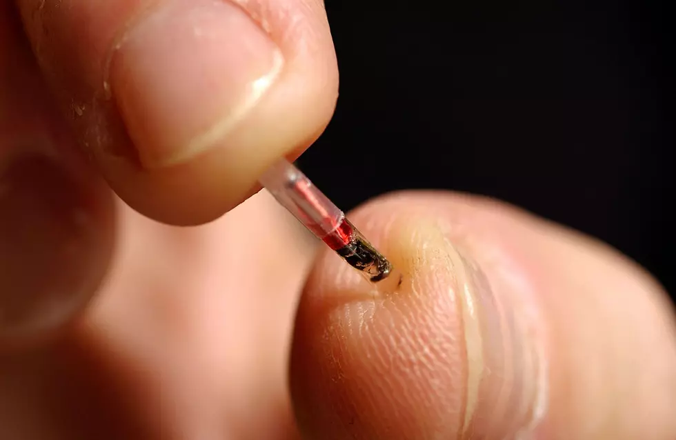 Should Companies Be Allowed To Micro-Chip Their Employees? [POLL]