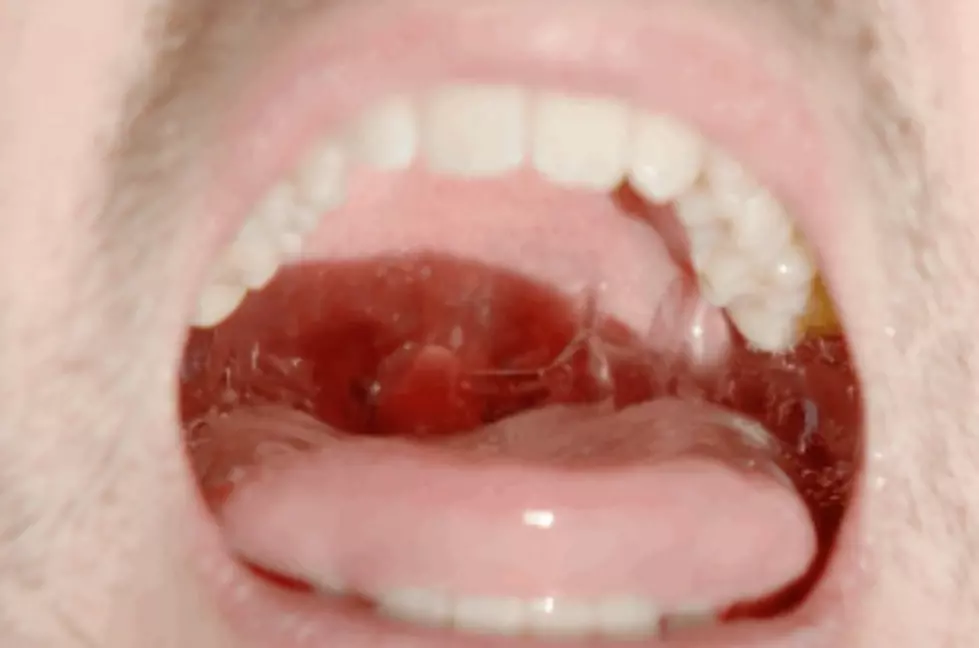 Slow Motion Video Of What Happens When You Gargle