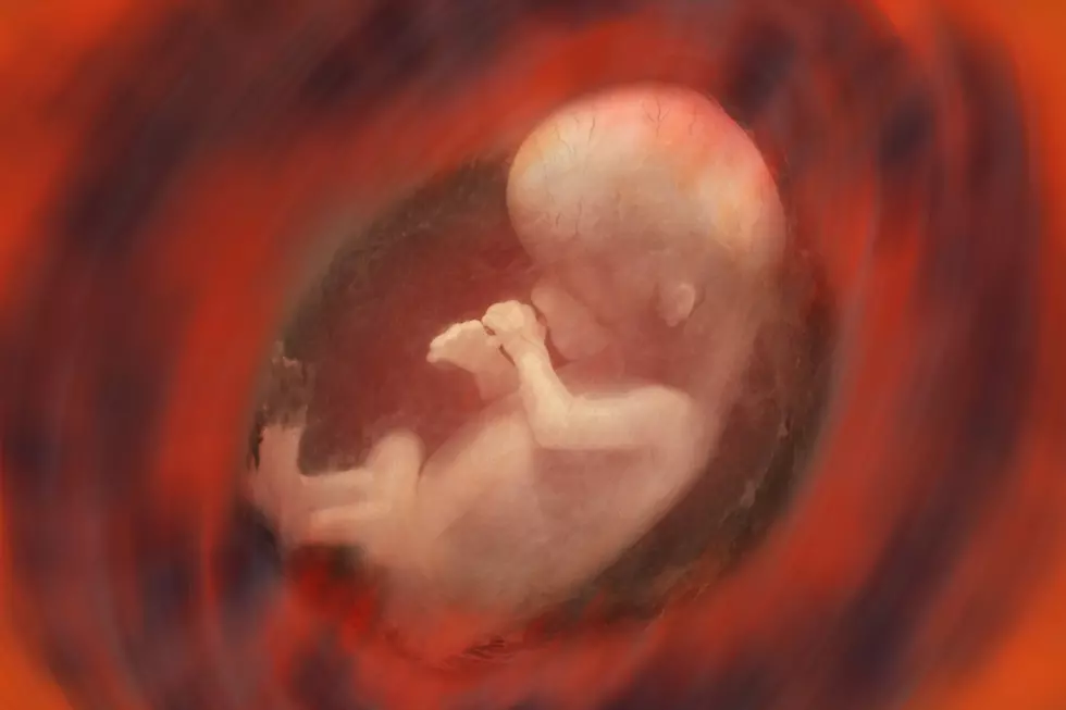 AL Man Files Suit on Behalf of Aborted Fetus