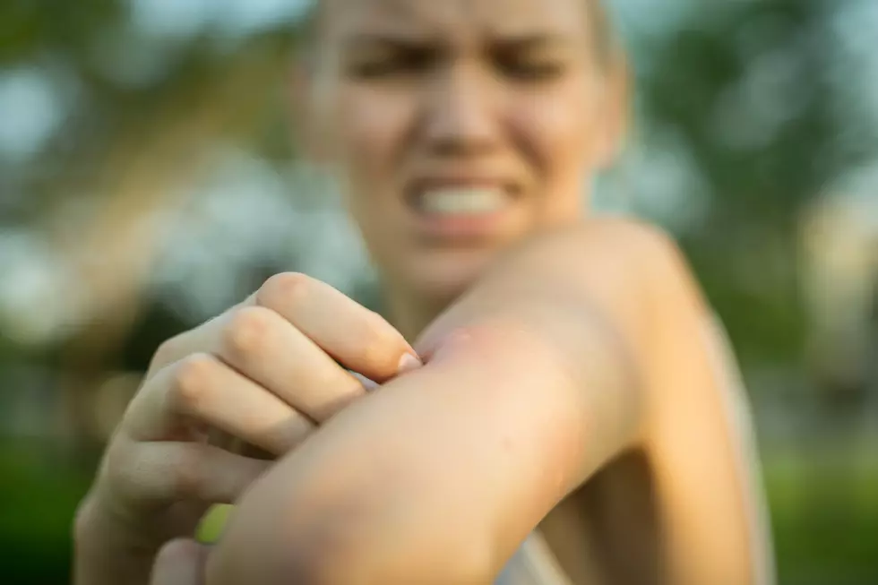 Hey Bangor-What’s Your Go-To For Mosquito Bite Relief?