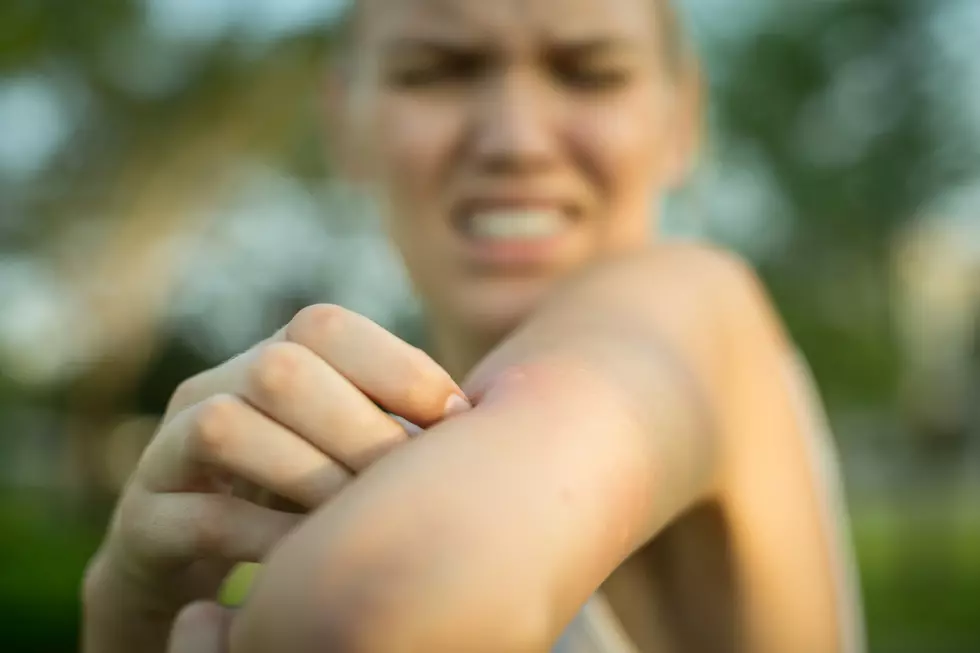 What’s Your Summer Time Go-To For Mosquito Bite Relief In Maine?