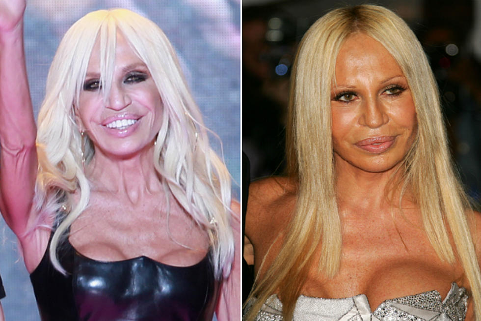 No. 4: Donatella Versace – Worst Celebrity Boob Jobs