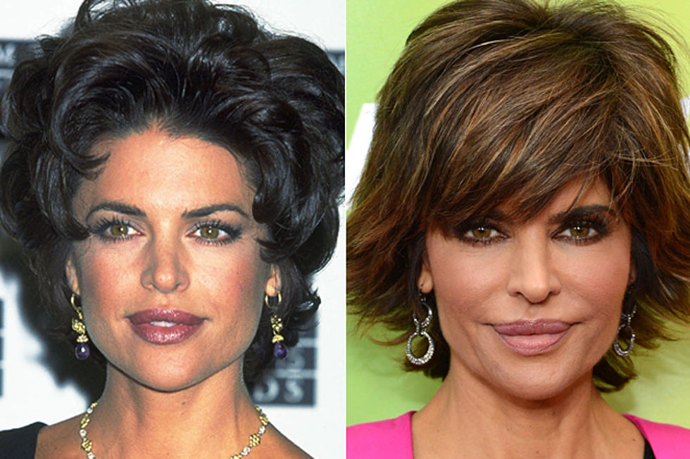 Lisa Rinna Plastic Surgery Pictures