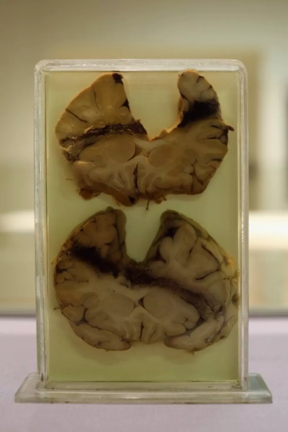 Brains Found On The Side Of The Road [PHOTO]