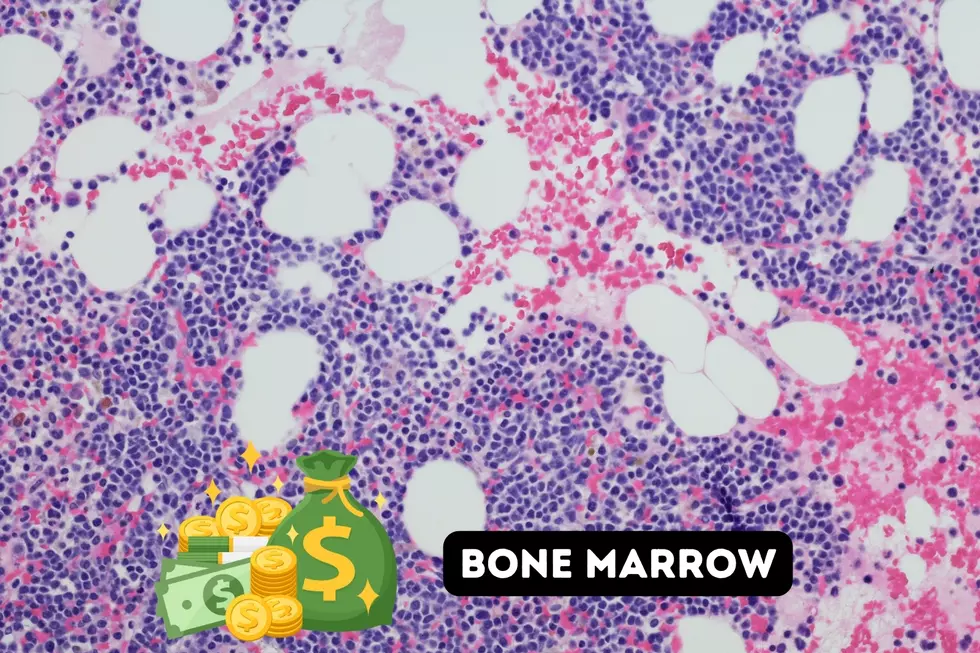 Bone Marrow - Photo: WPGG/TSM Illustration