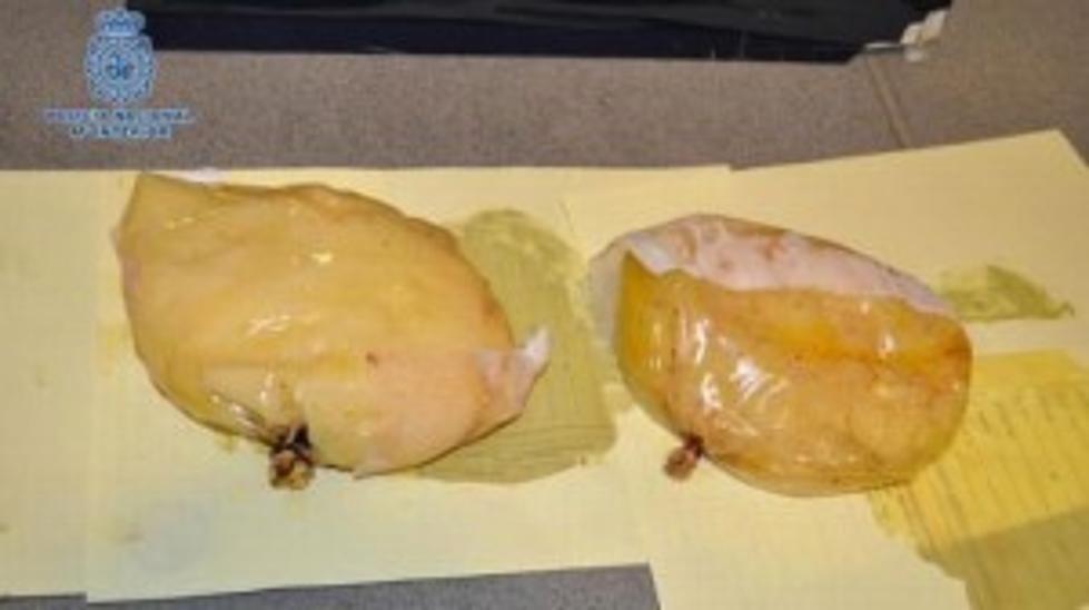 Woman Arrested For Breast Implant Gone Wrong [VIDEO]