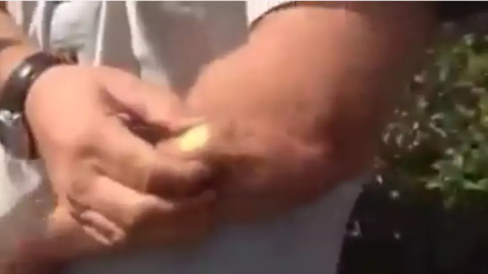 Paintball Penetrates Man’s Arm, Pops It Out Like A Pimple