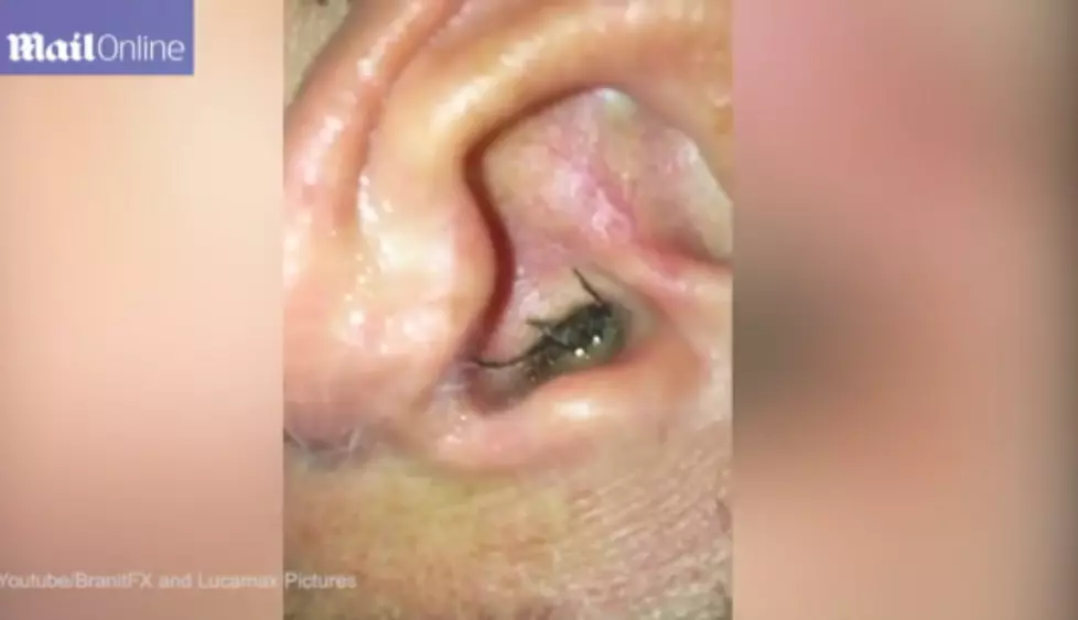 Man Finds Huge Spider Living in His Ear