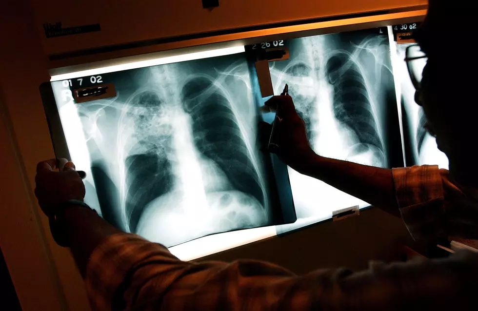 35 Cases Positive For Tuberculosis + More Local News