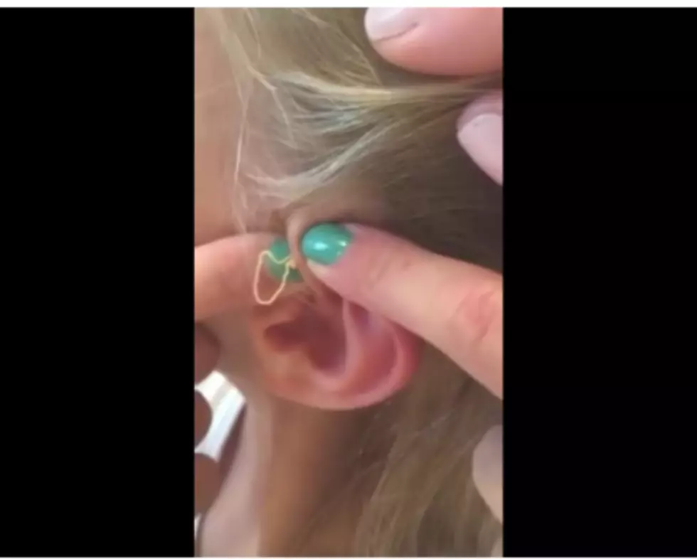 Girl Pops 6-Year-Old Zit