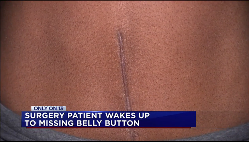 Texas Woman Suing Doctor for Removing Navel During Surgery