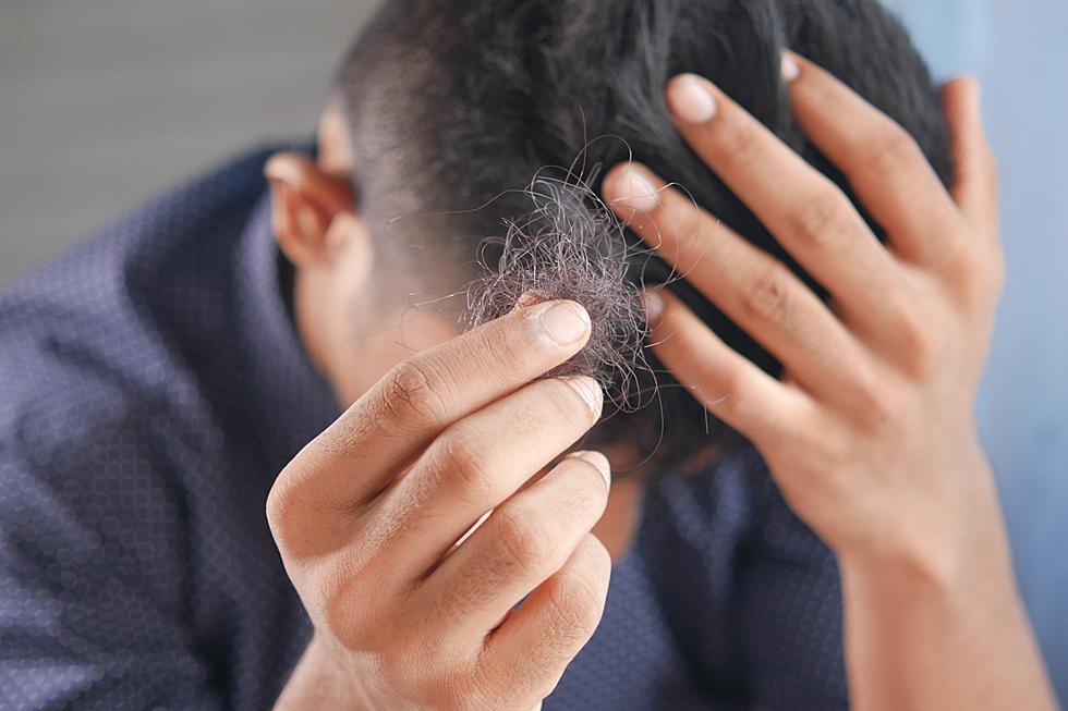 Scientists Reveal NEW Cure For 'BALDING,' Here's How To Get Help