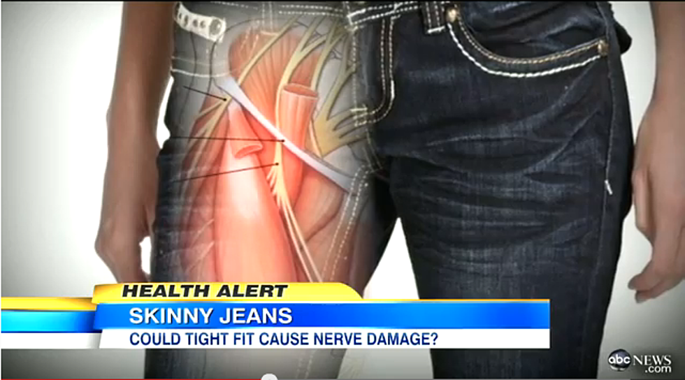 Can Skinny Jeans Give You Nerve Damage? [VIDEO]