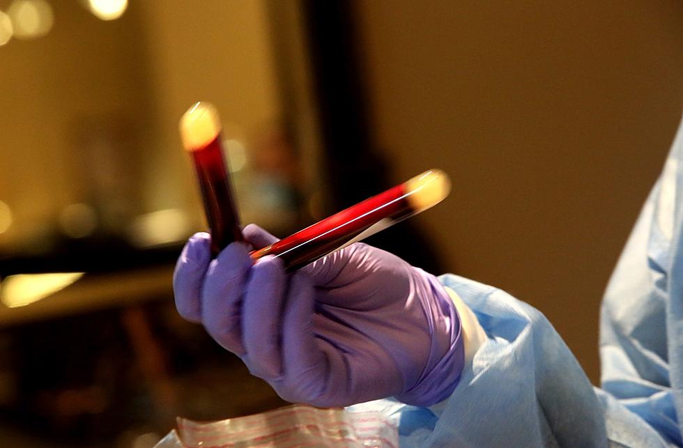 Free Hepatitis C Testing Open To El Paso Residents In May