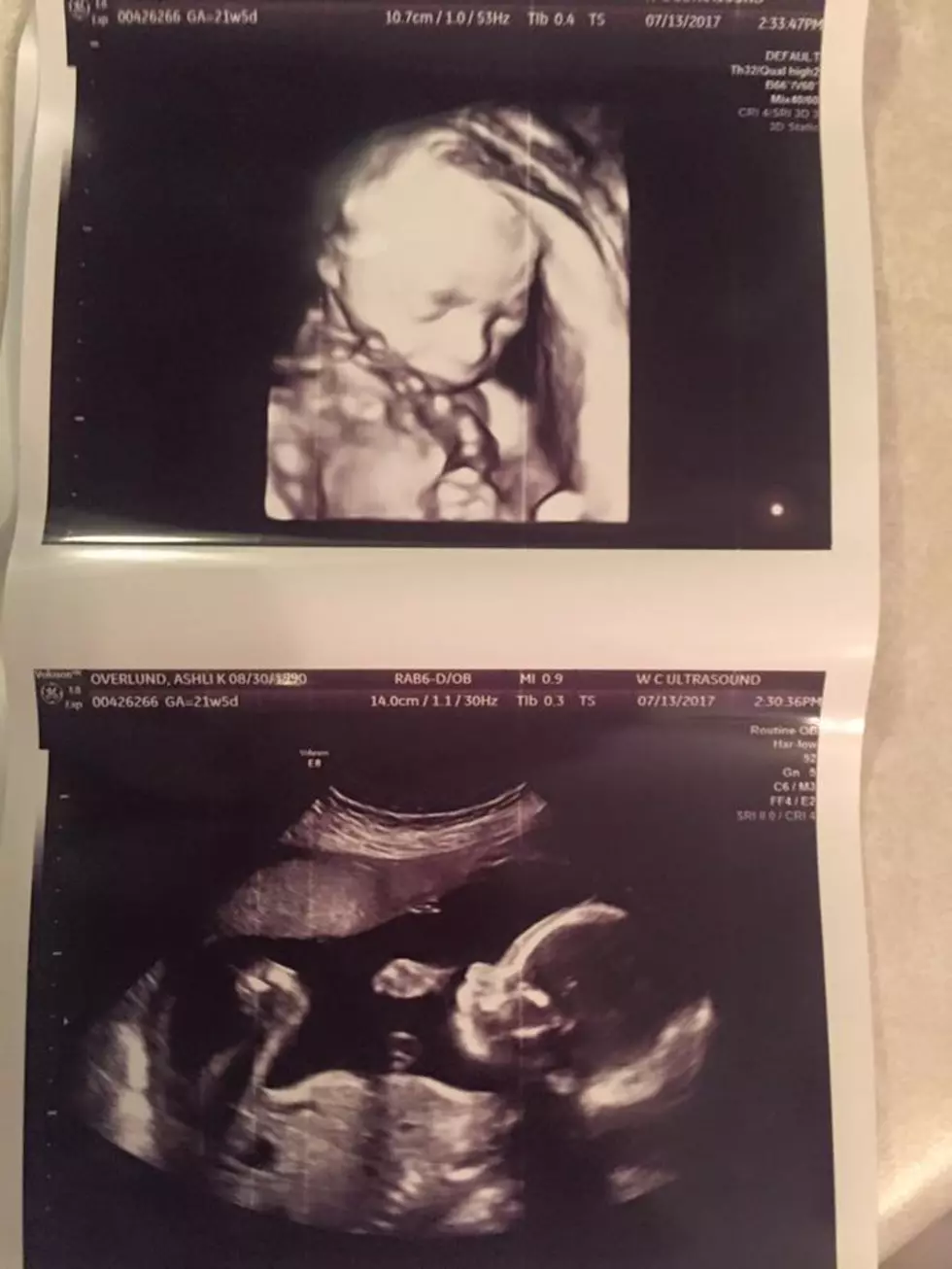 I Found Out My Baby’s Gender Yesterday [ULTRASOUND PICS]