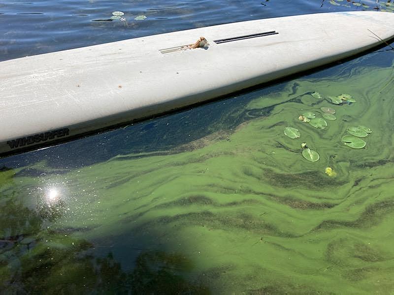 Toxic Algae in Southwest Michigan's Austin Lake: A Vital Warning