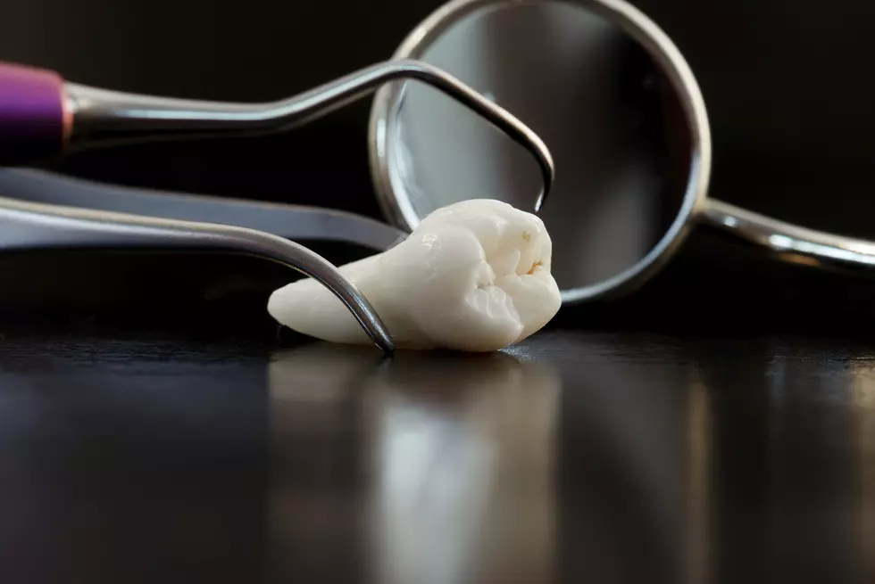 5 Foods You Never Want to Eat Again After a Tooth Extraction