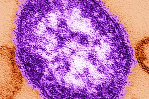Minnesota Measles Outbreak Persists