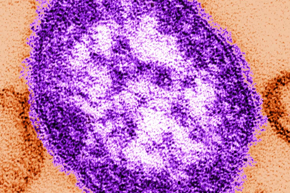 Minnesota Measles Outbreak Persists