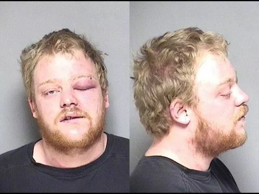 Stewartville Man Accused of Breaking Girlfriend’s Mother’s Nose