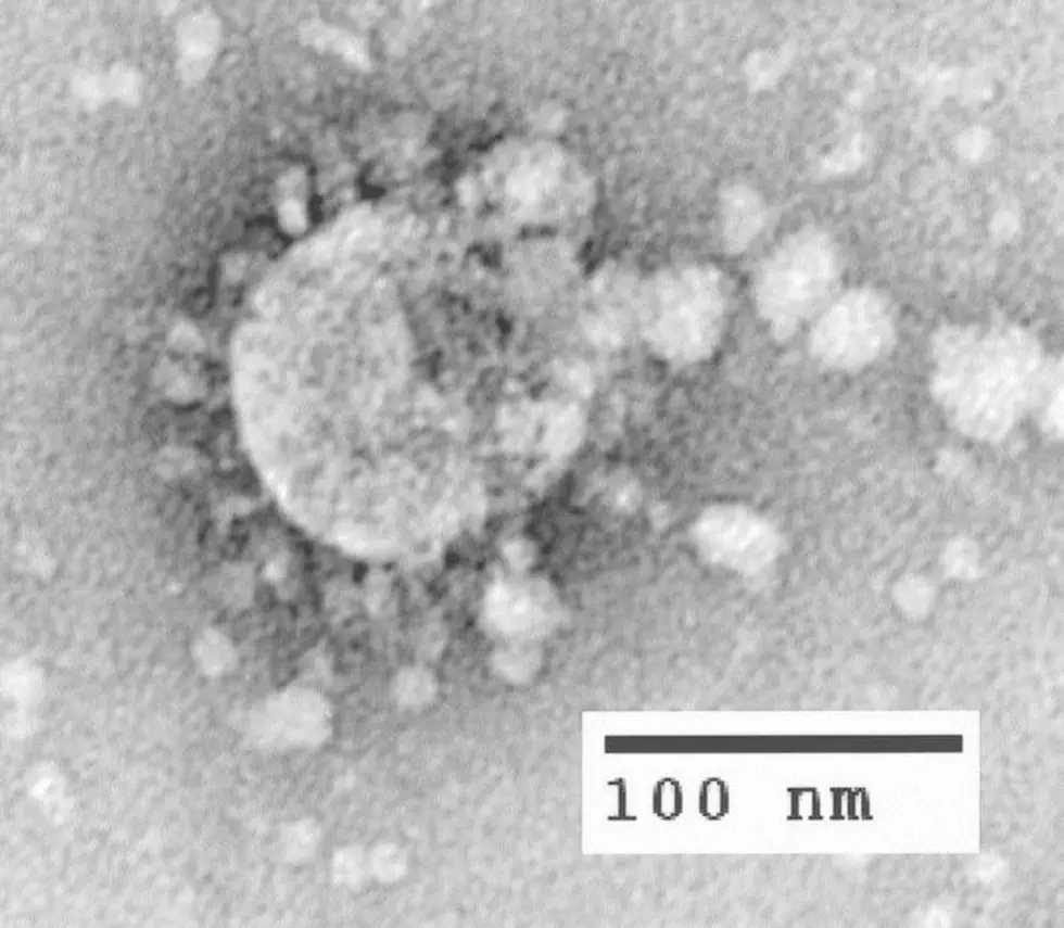 Minnesota Health Officials Report 2nd Case of Coronavirus