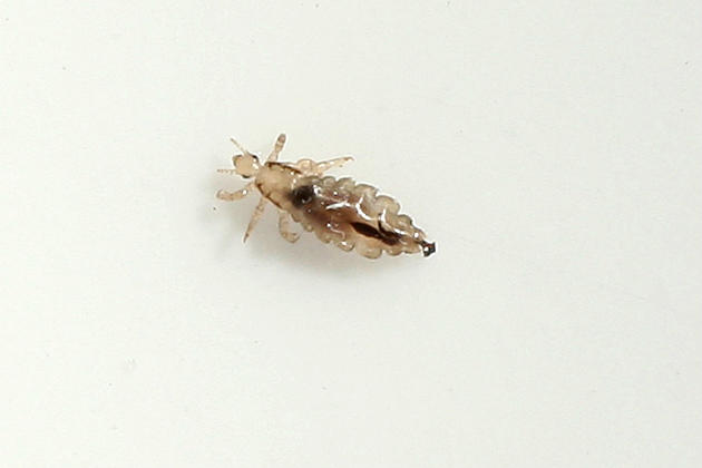 St. Cloud Clinic to Hold Free Head Lice Treatments