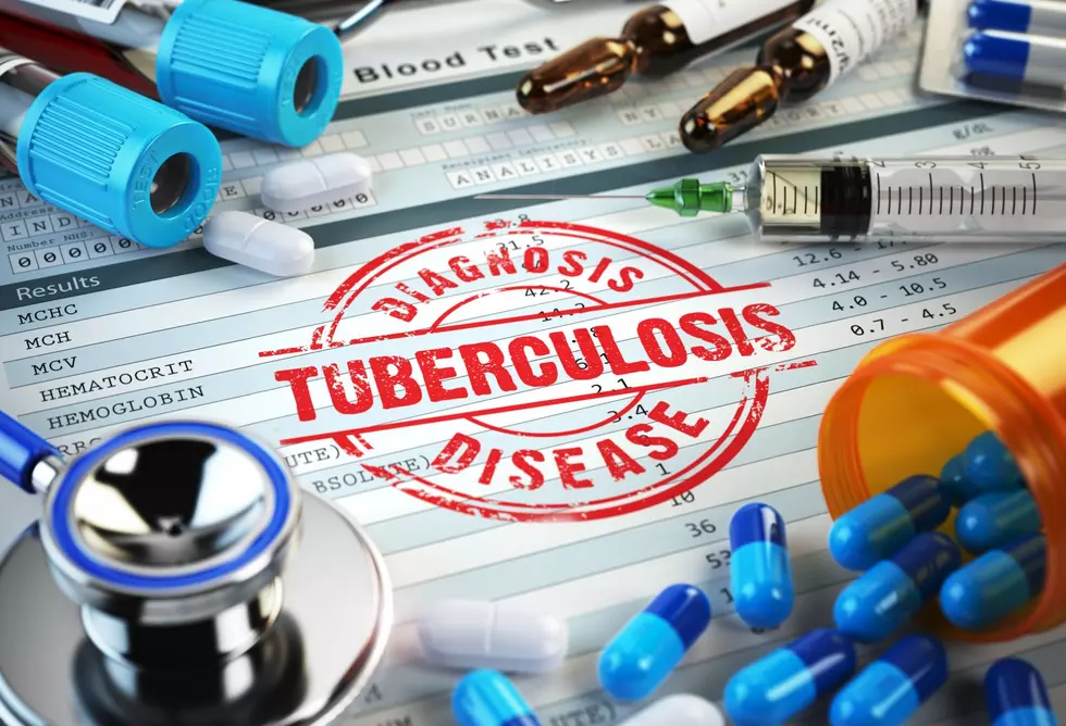 Tuberculosis Outbreak Associated with Mankato University