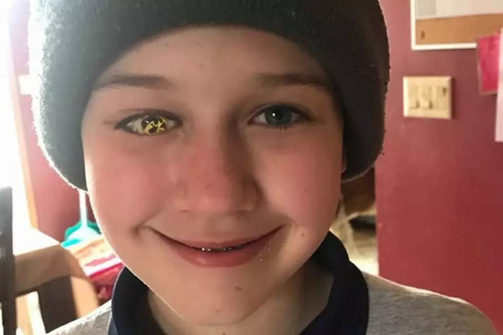 Iowa Boy Has Prosthetic Tigerhawk Eye Made in the Corridor