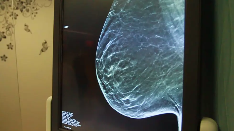 Behind The Scenes Of A Mammogram [Watch]