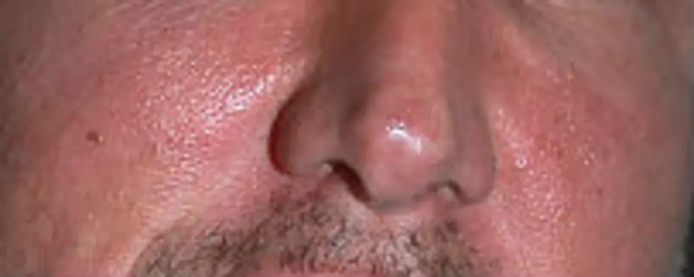 Which Country Star Belongs to this Nose ?