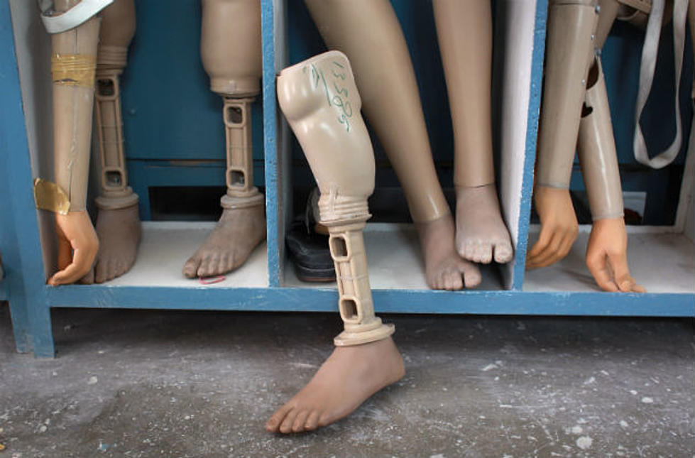 Two-Year-Old with Prosthetic’s Takes His First Steps [VIDEO]