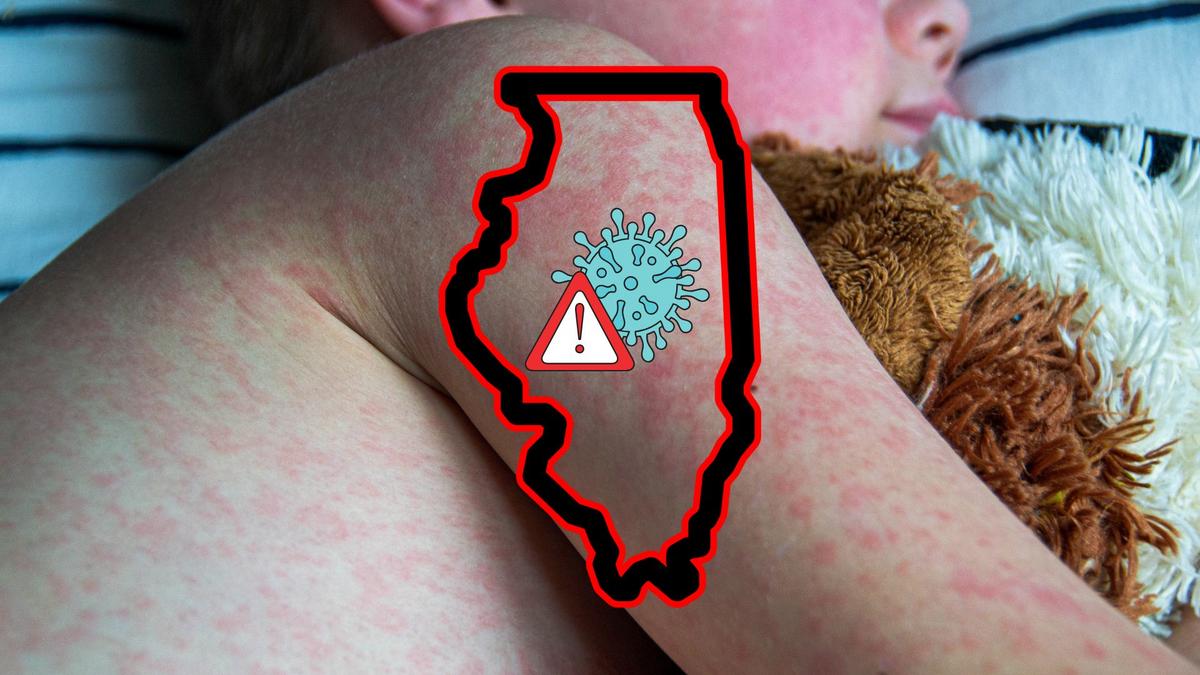 Illinois Monitoring Spread of Highly Infectious Disease as Students Prepare to Return