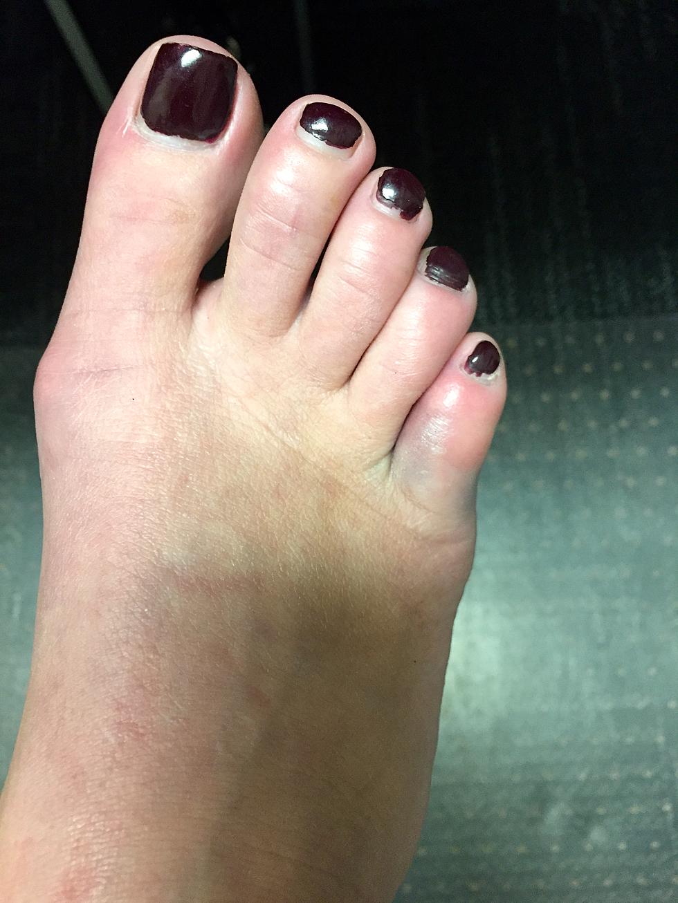 Ouch!  Is My Toe Broken?