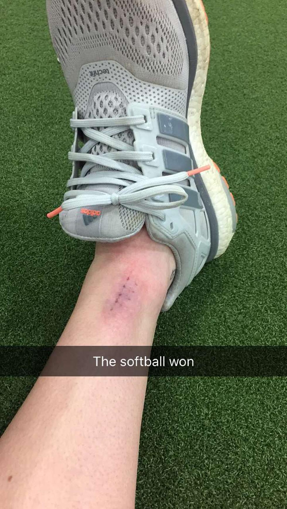 Play Softball They Said, It Will Be Fun They Said