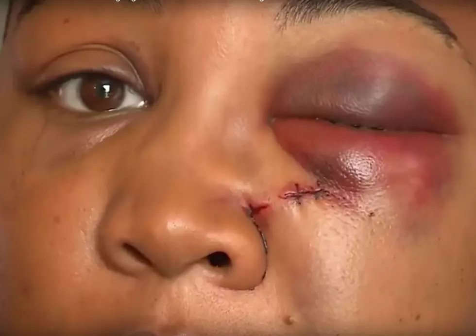 McDonald's Manager Breaks Ohio Woman's Nose After Wrong Order