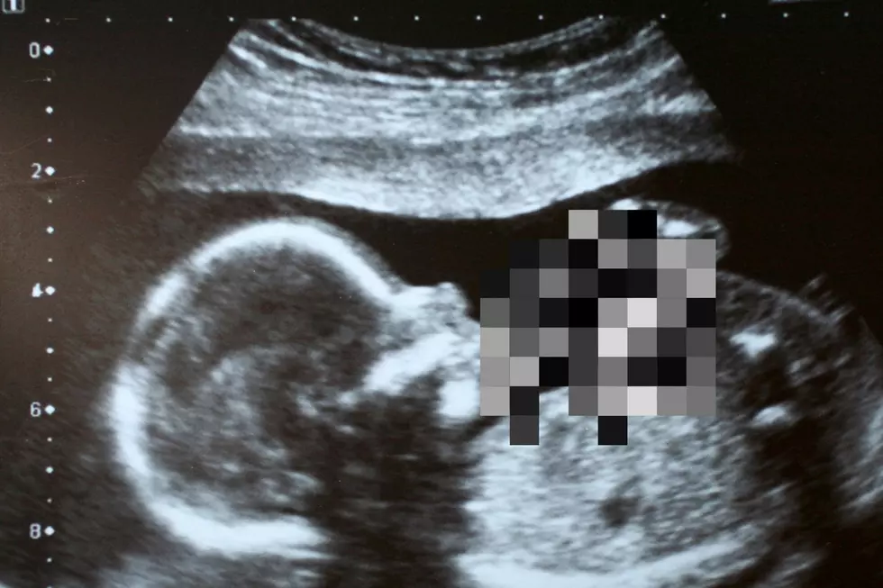 Indiana Fetus Flashes Peace Sign in Ultrasound Picture