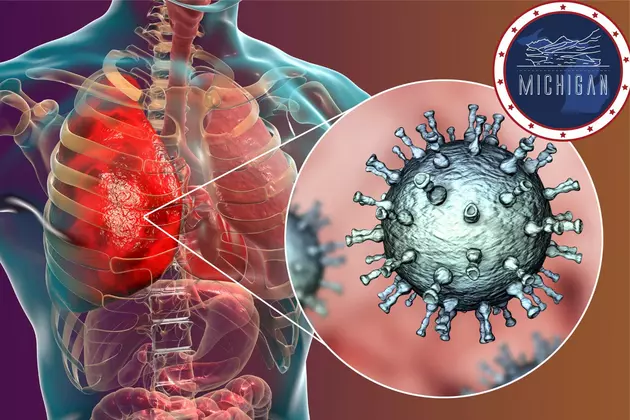 BEWARE: CDC Warns Dangerous Disease Spreading In MI, Cases Rise