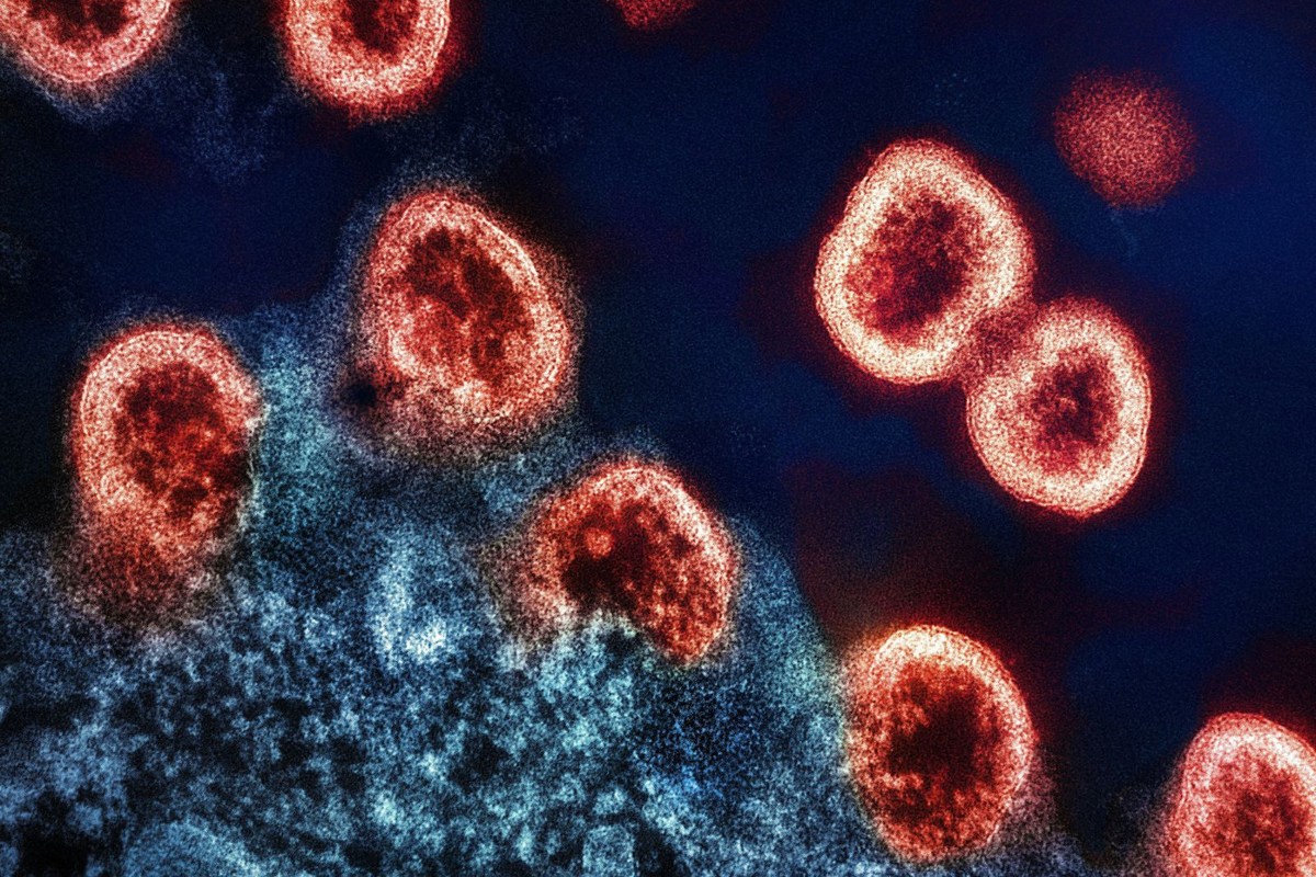 Highly Contagious Viral Disease Spreading In Indiana Schools