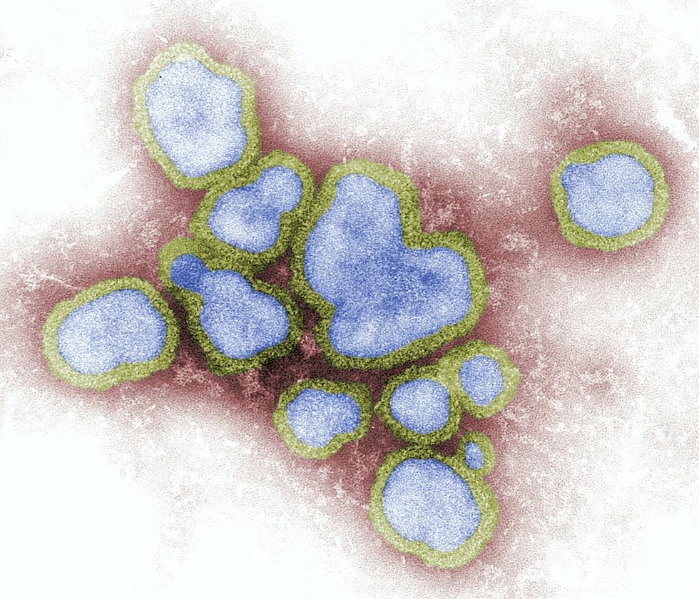 Former FDA Chief Says Flu Season Could Be A Whopper in Kalamazoo