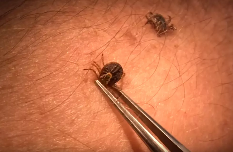 RETURN OF THE TICKS! How to Remove ’em From Your Skin