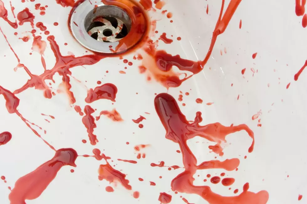 A white sink with what appears to be blood.