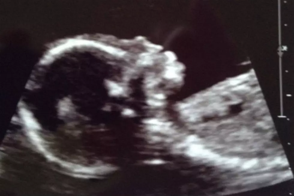 It’s a Girl: Joey and Mrs. Pants Are Expecting