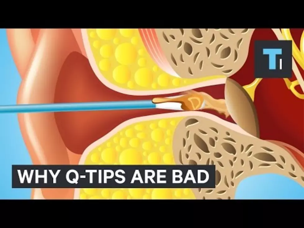 Do You Use Q Tips To Clean Your Ears After Watching This Video You Might Want To Stop 