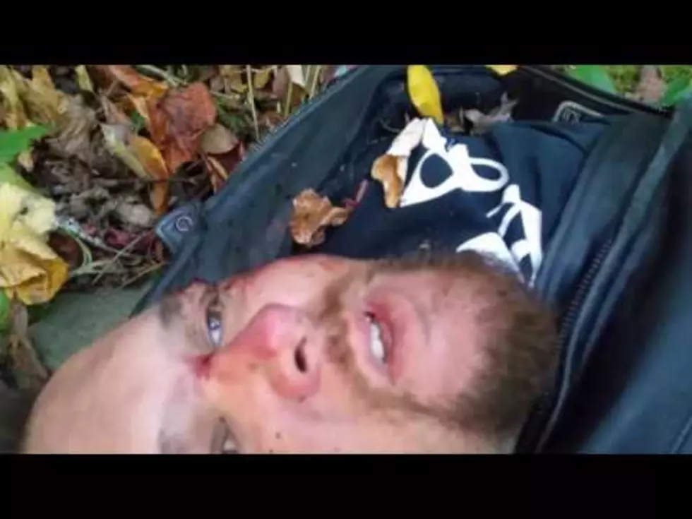 Guy Says His Final Goodbyes To His Friends And Family After Horrific Motorcycle Accident [VIDEO]
