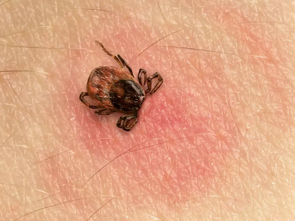 Mainers Are Being Reminded To Save Ticks For Testing If You Get Bit