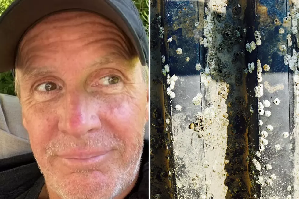 Skin Barnacles Are a Real Thing and Maine Comedian Bob Marley Has the Cure