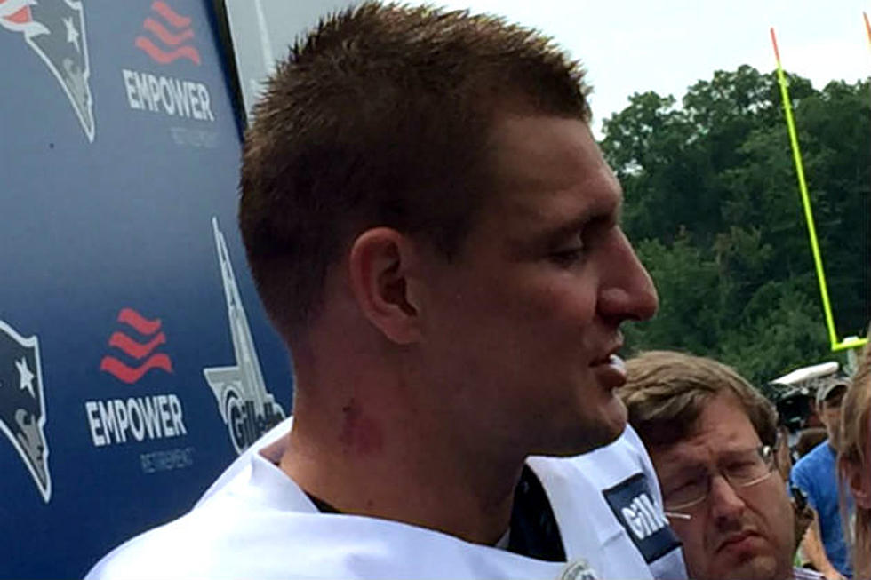 OMG, Gronk! Is That A Hickey?! Why Yes, It Is!